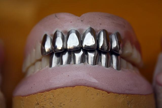 3. ‌Considerations for Denture Wearers: Weighing the Pros and Cons of Traditional and Implant-Supported Dentures